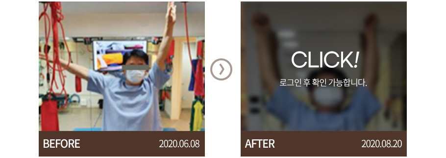오십견