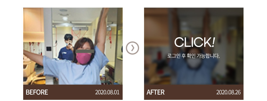 오십견