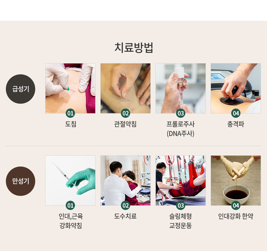 오십견