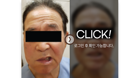 치료사례