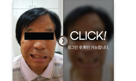 치료사례
