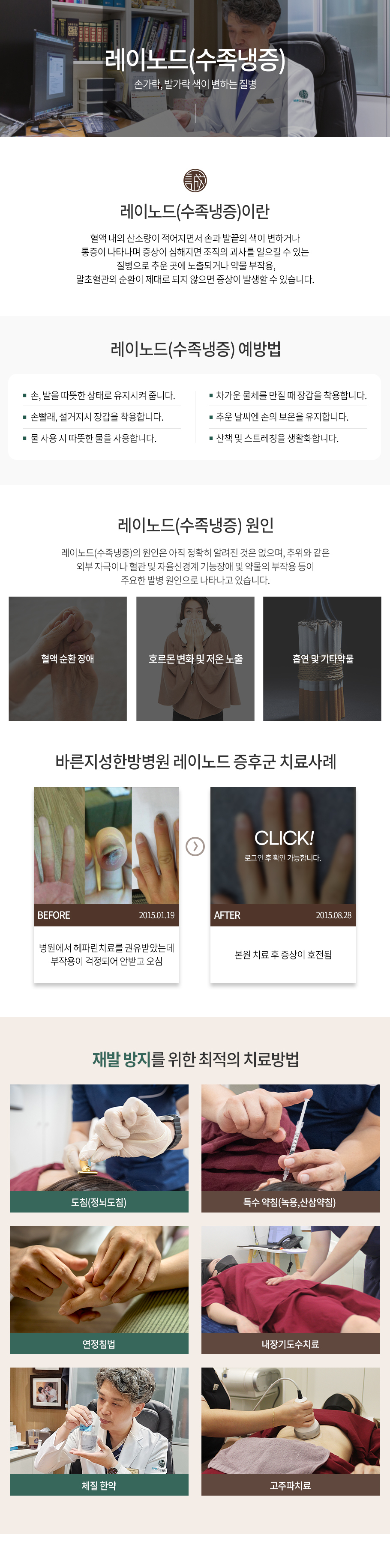 레이노드