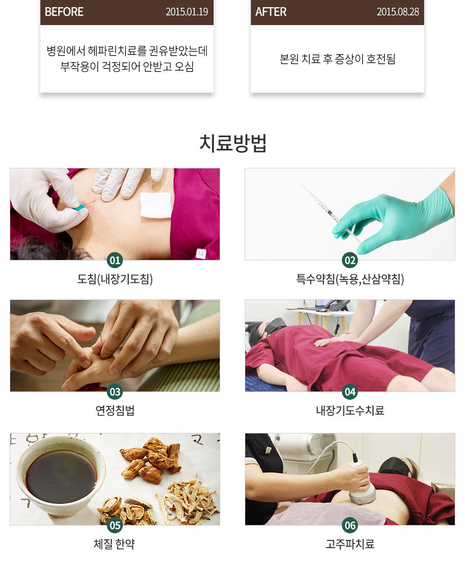 레이노드