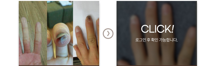 레이노드
