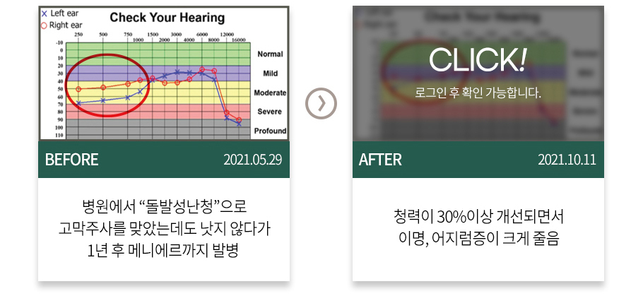 바른 침치료