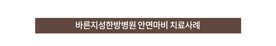 바른 침치료