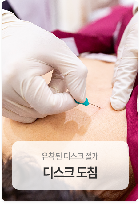 디스크도침