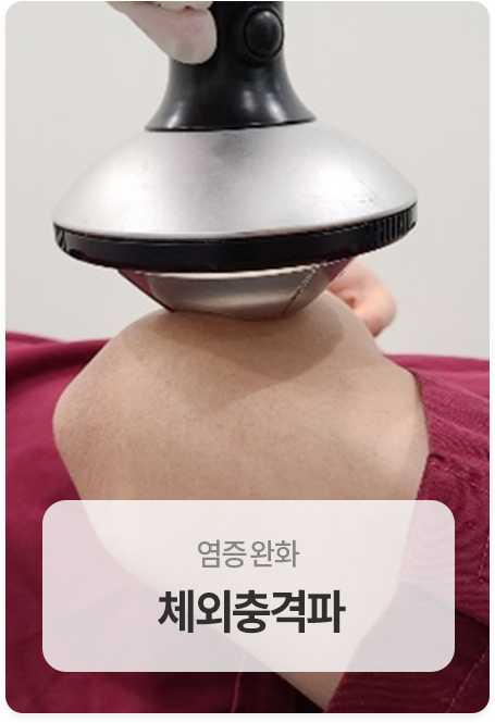 체외충격파