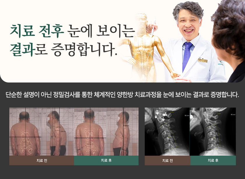 치료결과로 증명