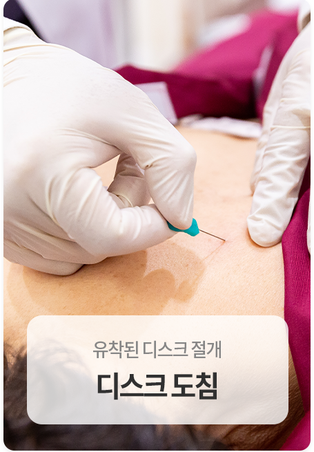 디스크도침