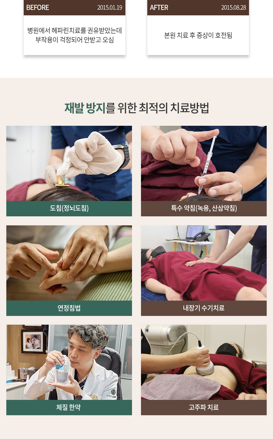 레이노드